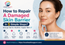 How to Repair A Damaged Skin Barrier in 5 Simple Steps